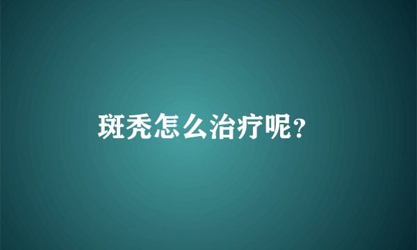 斑秃怎么治疗呢？