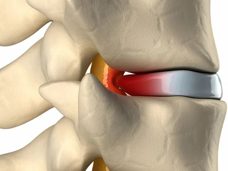脊髓灰质炎减毒活疫苗糖丸的作用与功效