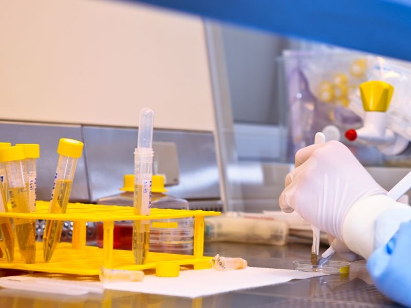 肝功能化验单怎么看