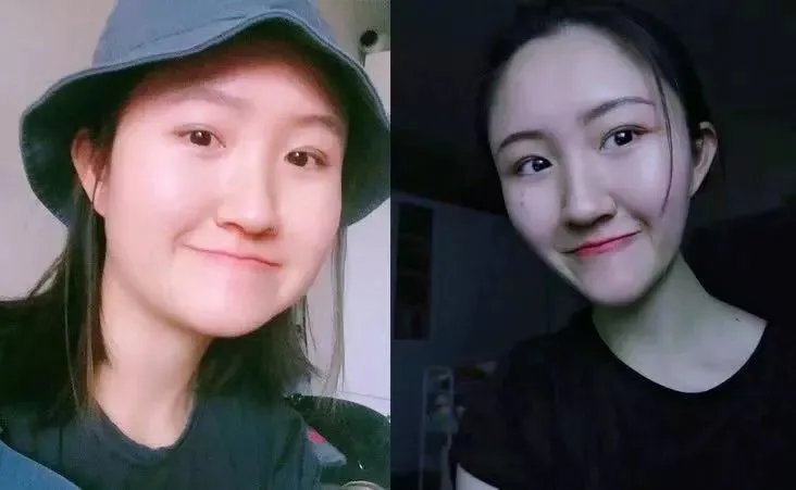 大S瘦脸前后判若两人:不手术、不打针,如何在一个月内瘦出明星V脸?