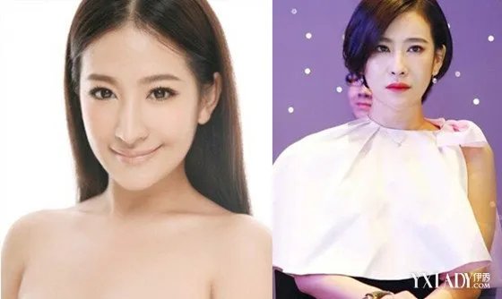 郭柯彤整容失败照片曝光网曝其整容失败越来越丑