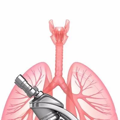 治肺癌有什么偏方