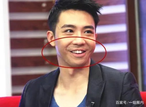 被烧伤后的俞灏明大变样,现在发展的怎么样?