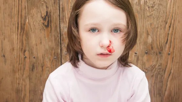 流鼻血应该怎么处理