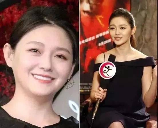 大S瘦脸前后判若两人:不手术、不打针,如何在一个月内瘦出明星V脸?