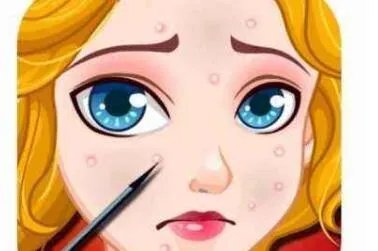 激光治疗痤疮怎么样