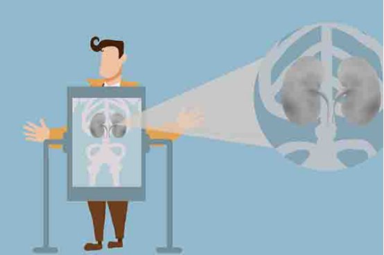 肾结石不能吃什么食物