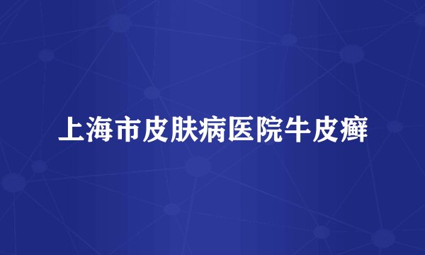 上海市皮肤病医院牛皮癣
