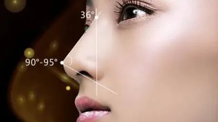 深圳哪家医院假体隆鼻好