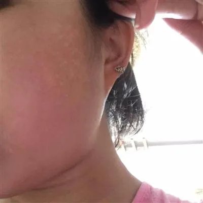 最好的祛斑方法