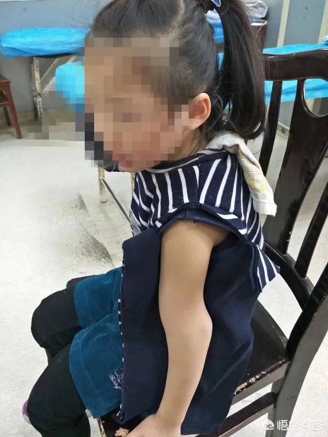 重庆一女童在幼儿园摔骨折，家长怀疑是老师报复，你怎么看？