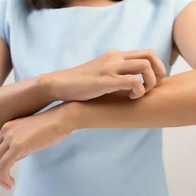 白癜风病因有什么