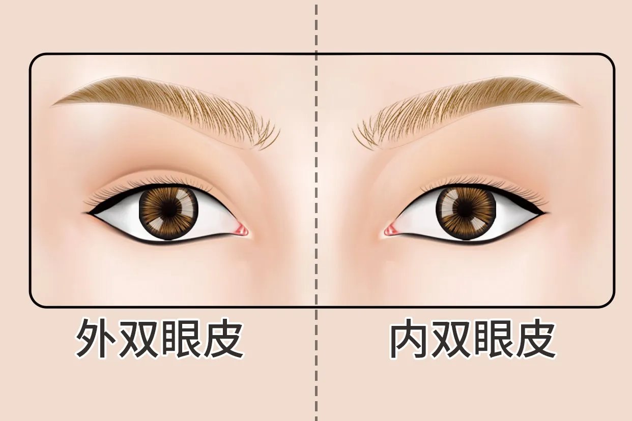 内双眼皮图片