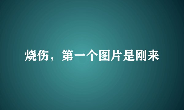 烧伤，第一个图片是刚来