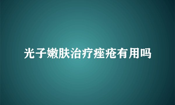 光子嫩肤治疗痤疮有用吗