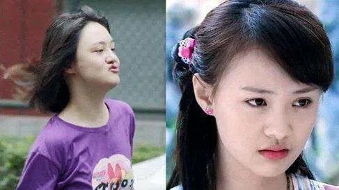 整容成猪鼻!韩国女星不小心撞断鼻子再次整容,术后仍像二师兄,你怎么看?