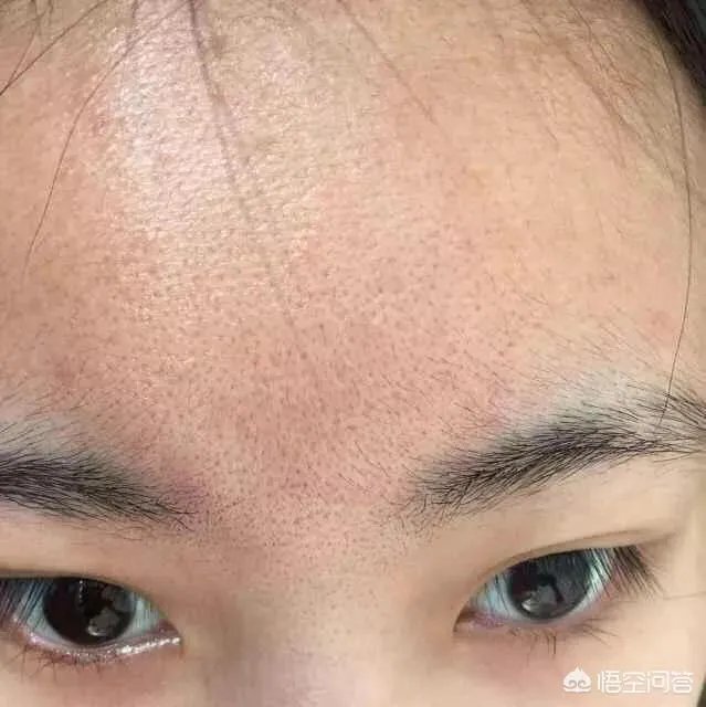 本人皮黄,混合皮肤,毛孔有点粗,很想买一种适合自己的护肤品,怎么选择?