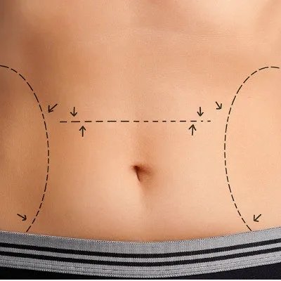 露卡素左旋肉碱效果怎么样?