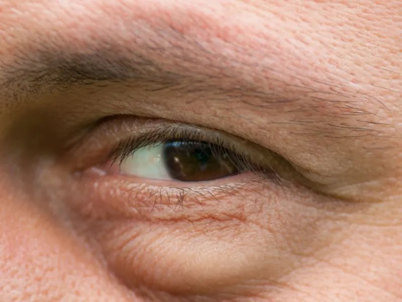 右眼皮跳是由哪些原因造成