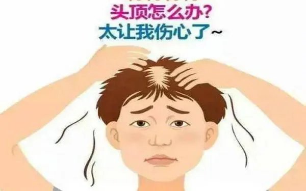 头发种植术多少钱