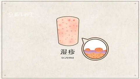 身上长红点怎么回事