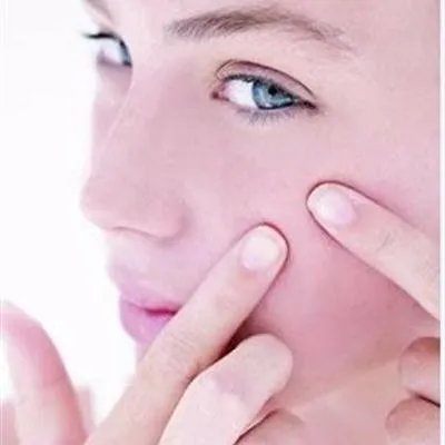 痤疮最佳治疗方法有哪些