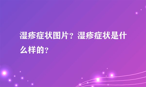 湿疹症状图片？湿疹症状是什么样的？