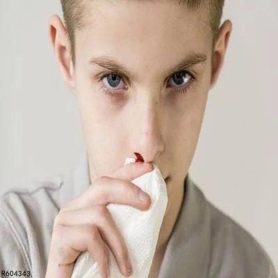 鼻子经常出血是怎么回事