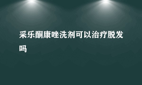 采乐酮康唑洗剂可以治疗脱发吗