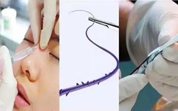 北京肋软骨隆鼻医院哪里比较好