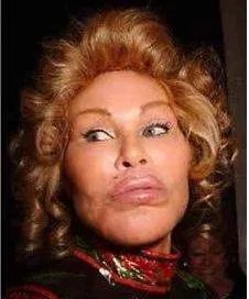 整容成猪鼻!韩国女星不小心撞断鼻子再次整容,术后仍像二师兄,你怎么看?