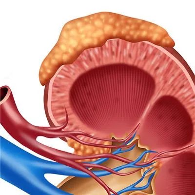 肾病中医怎么治疗？