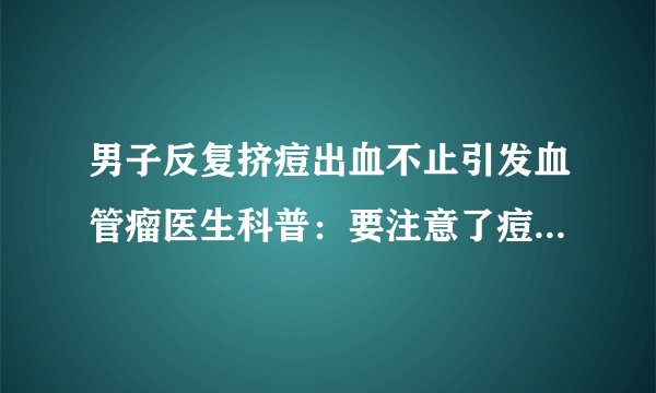 男子反复挤痘出血不止引发血管瘤医生科普：要注意了痘痘别乱挤