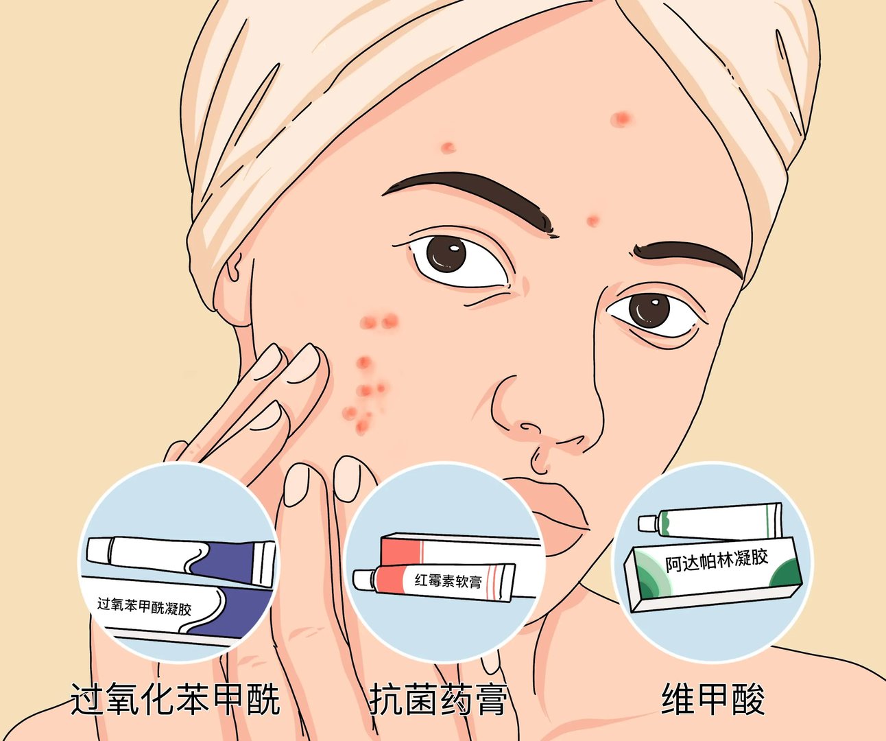 长痘用什么药膏