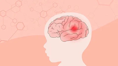 心脑血管硬化吃什么好