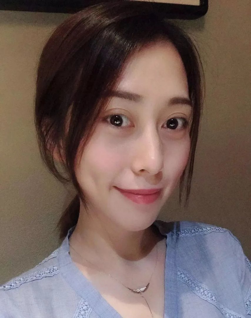 大S瘦脸前后判若两人:不手术、不打针,如何在一个月内瘦出明星V脸?