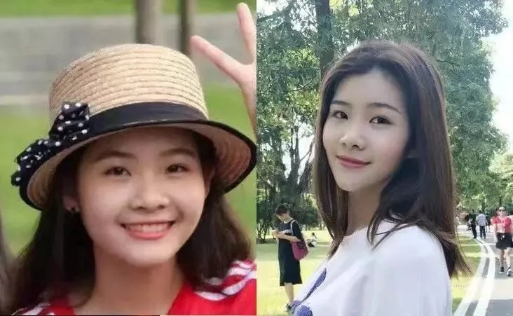 大S瘦脸前后判若两人:不手术、不打针,如何在一个月内瘦出明星V脸?