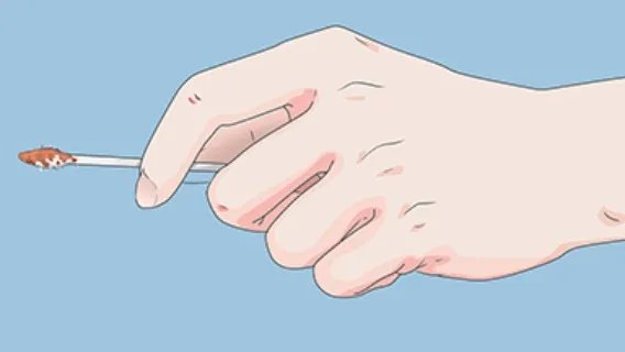 手上老年斑怎么去掉