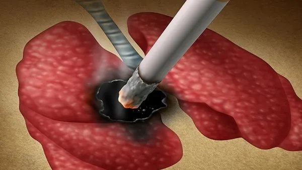 快速戒烟的方法和技巧 十个小偏方帮你快速戒烟