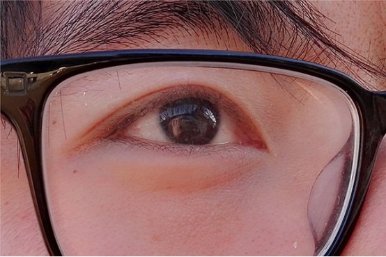 怎样让近视恢复