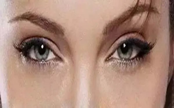 一般去眼袋手术多少钱