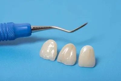 如何避免烤瓷牙危害