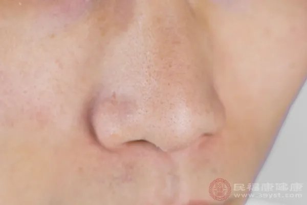 晚上鼻子不通气有哪些小妙招