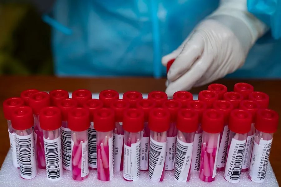 同管有阳性怎么处理