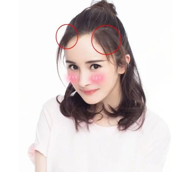 杨幂发际线回归是怎么回事？