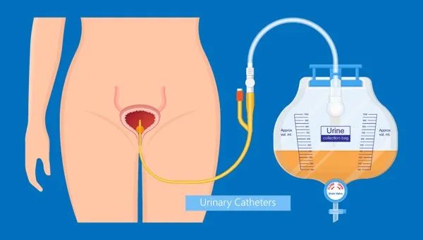 女人私密长得什么样子