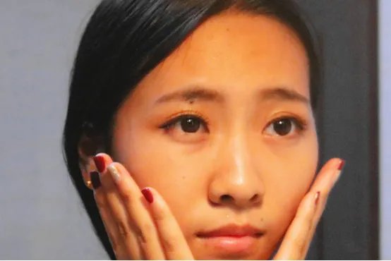 皮肤发黄是什么原因