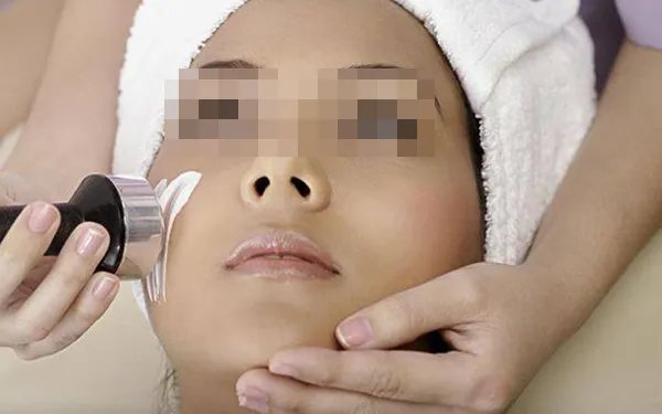 激光美容祛斑价格