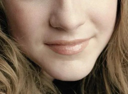 祛斑需要多少钱