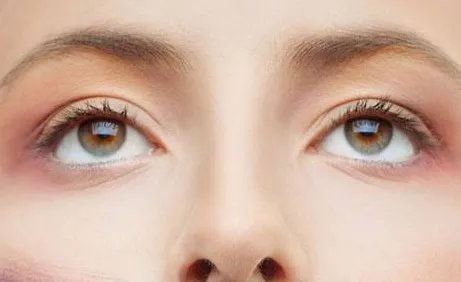 眼袋整形好处与坏处